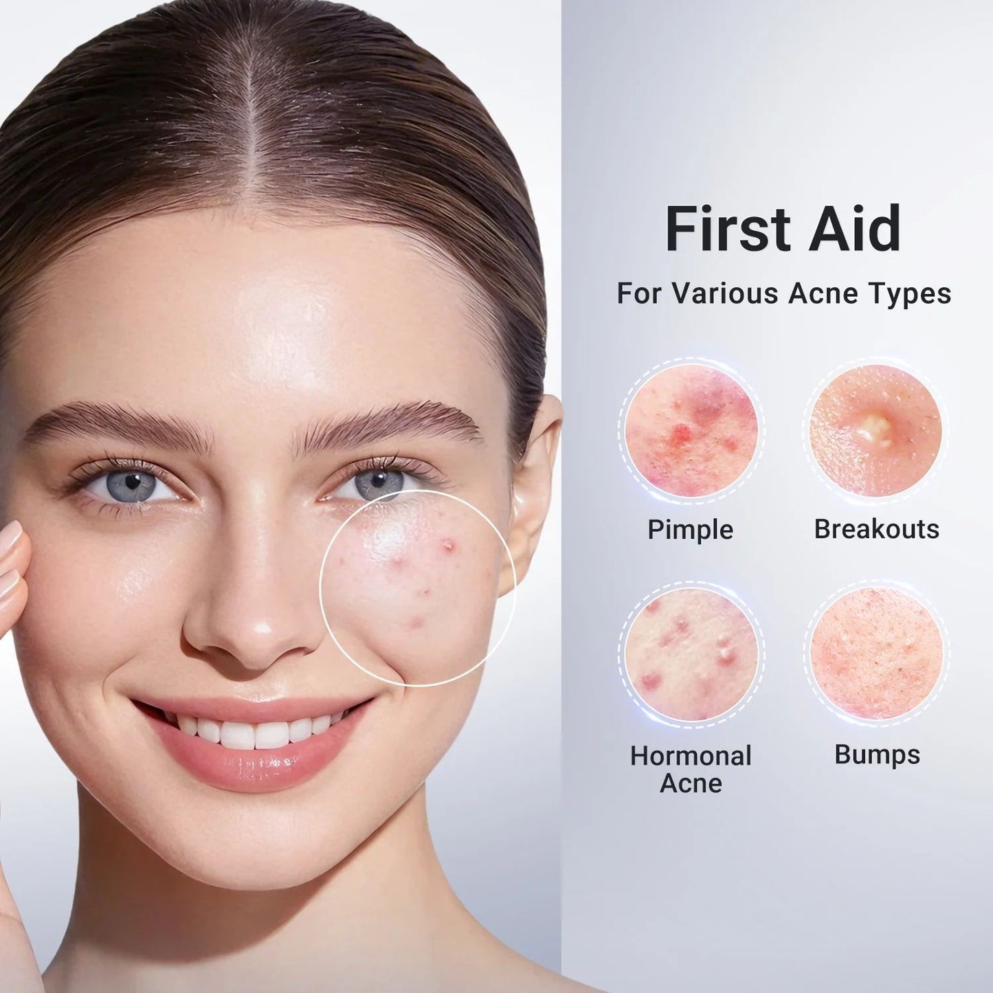 Acne-Fighting Serum with Salicylic Acid