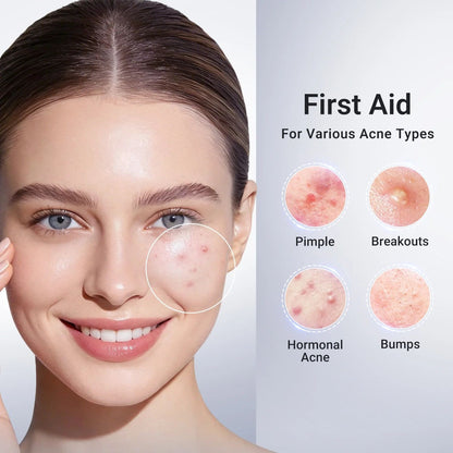 Acne-Fighting Serum with Salicylic Acid